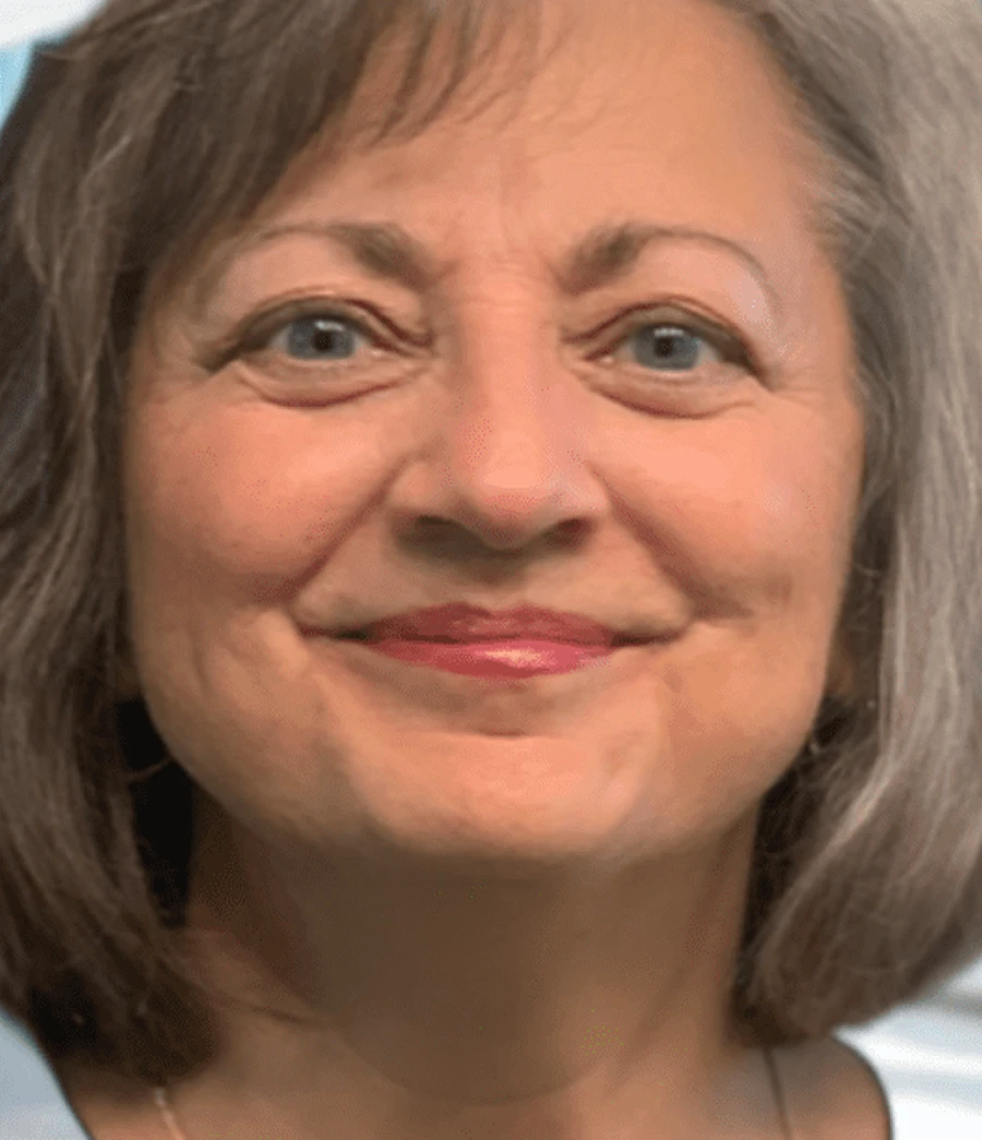 jocelyn-img